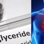 10 fruits that help bring triglycerides naturally and the 3 heart-healthy recipes