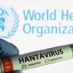 WHO declares Ebola outbreak global health emergency