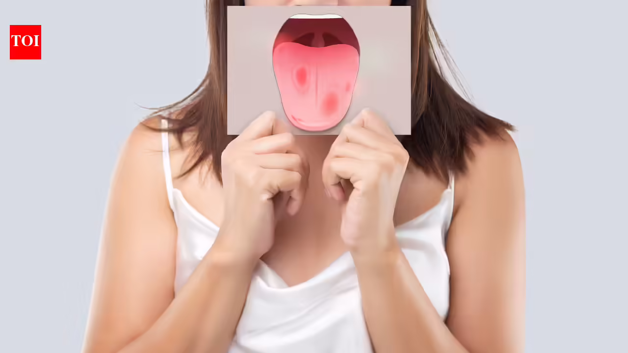 What your tongue colour may reveal about your health