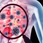 New tool can predict TB death risk at diagnosis, says study | India News