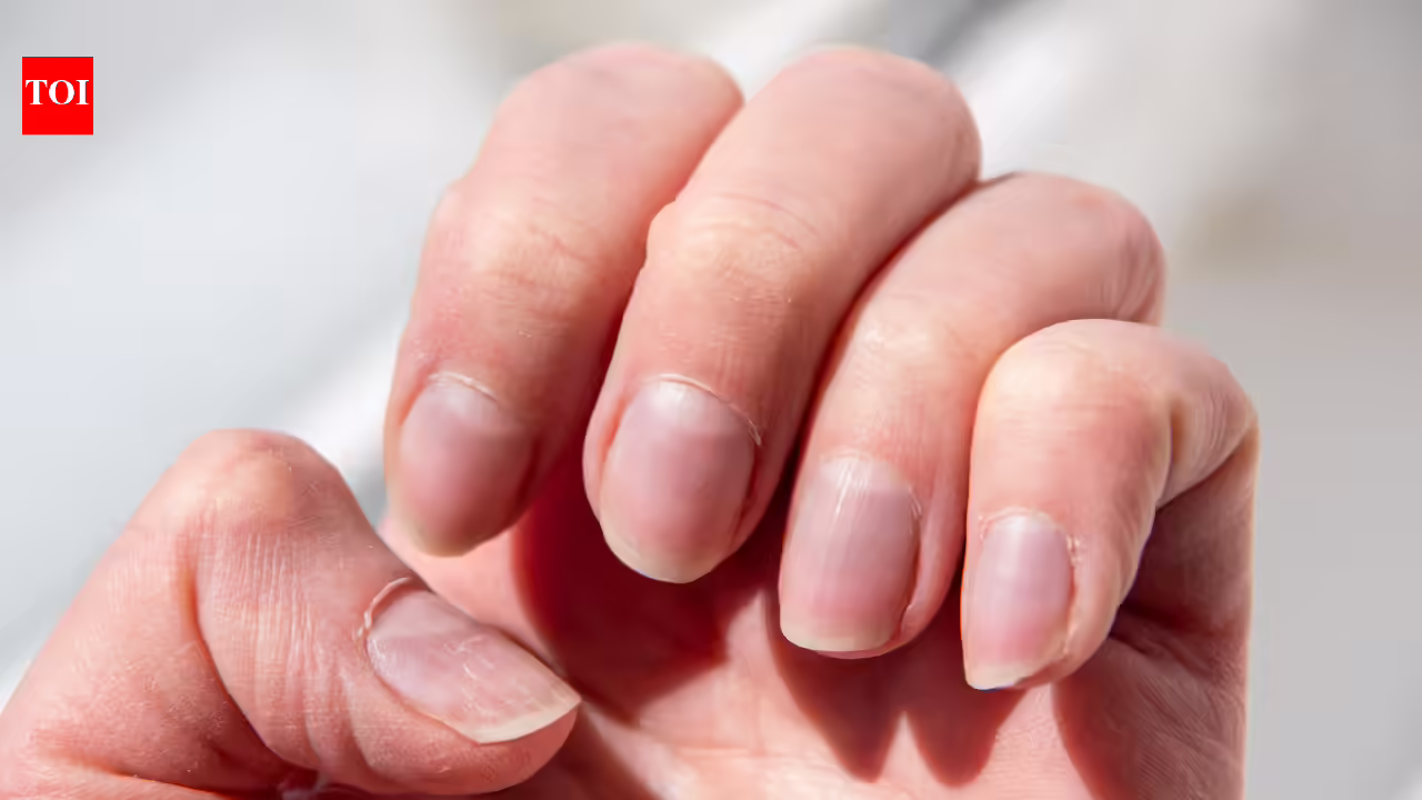 What your fingernails may reveal about health