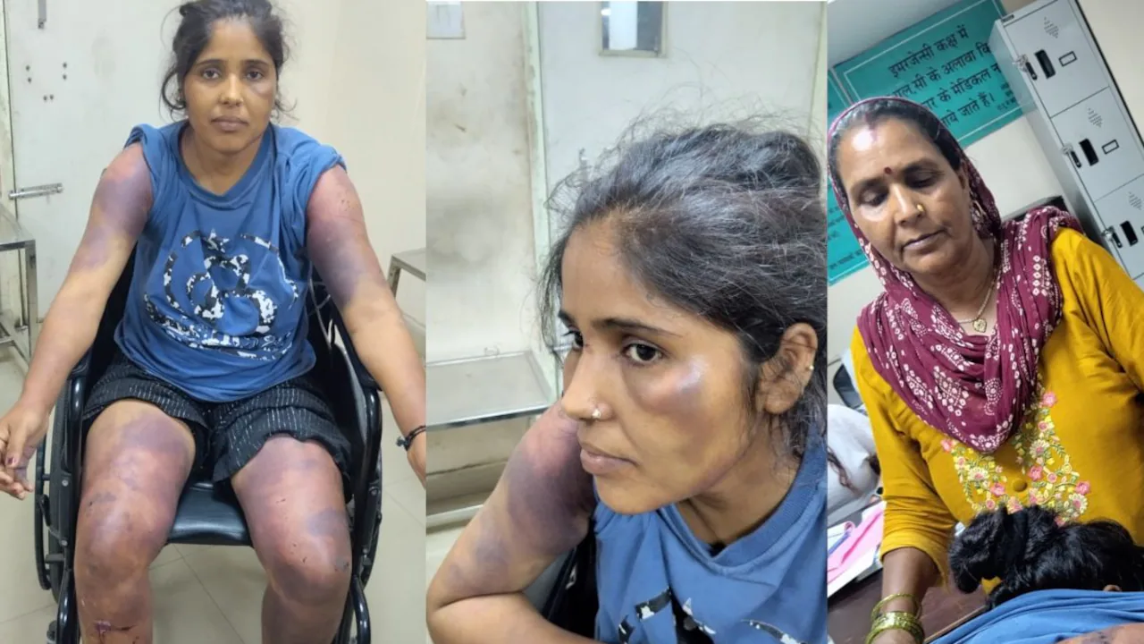 पत्नी को था इंस्टाग्राम का शौक, गुस्साए पति ने 8 माह की गर्भवती को बेरहमी से पीटा, गर्भ में ही मासूम की मौत | Domestic Violence Husband brutally beats eight-month-pregnant wife in Dehradun; unborn baby dies